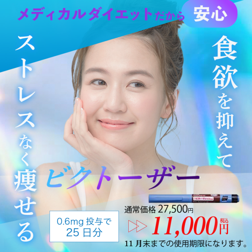 ビクトーザーバナー写真