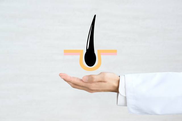 AGA治療の写真