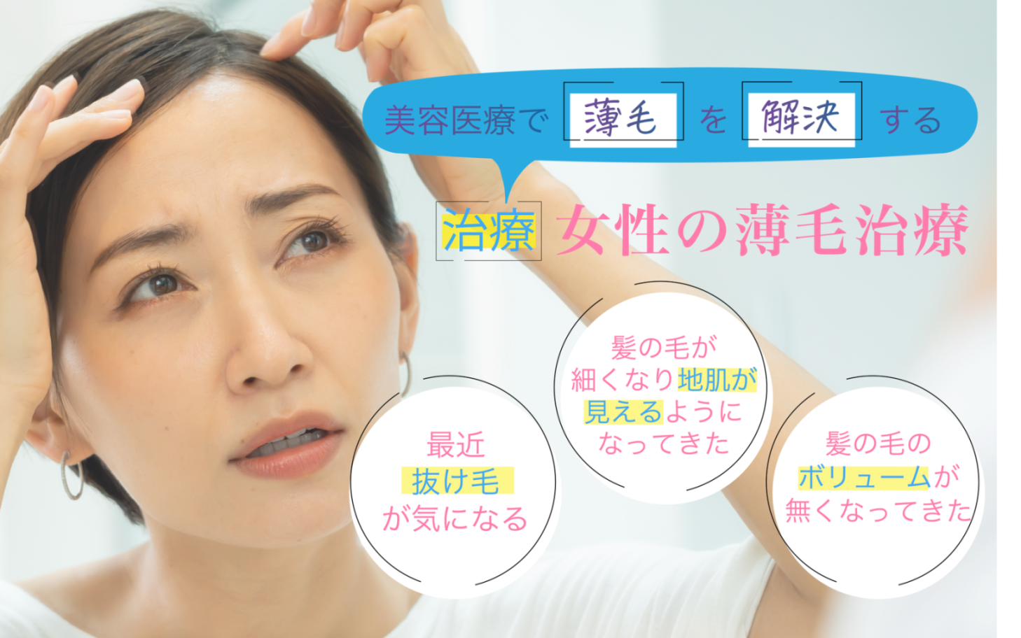 女性の薄毛治療を紹介するバナー写真